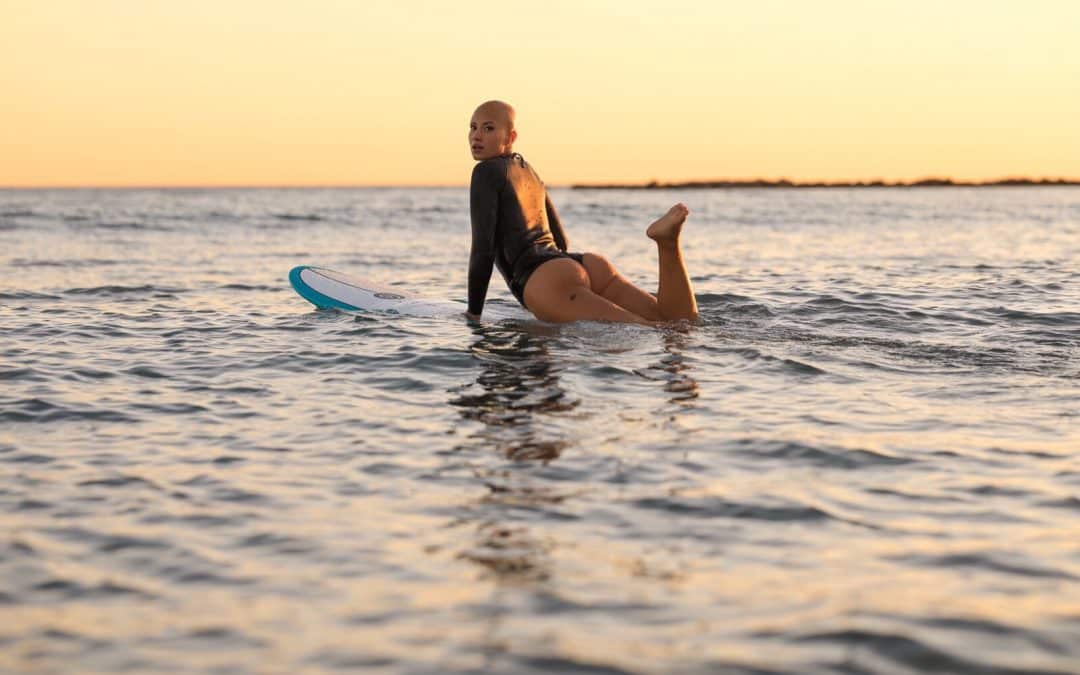 Alopecia, Surfing and How It Affected My Life